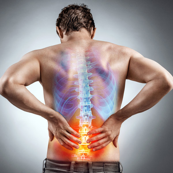 Sciatica Pain Relief Redding CA - Chiropractic First