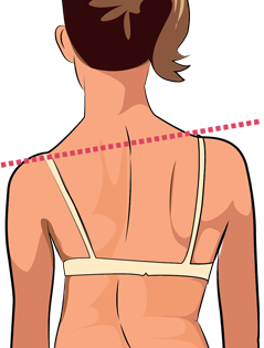 Scoliosis Assessment