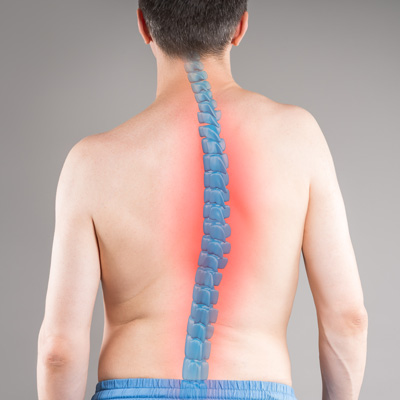 Non-Surgical Scoliosis Treatment: Effective, Personalized, and Proven